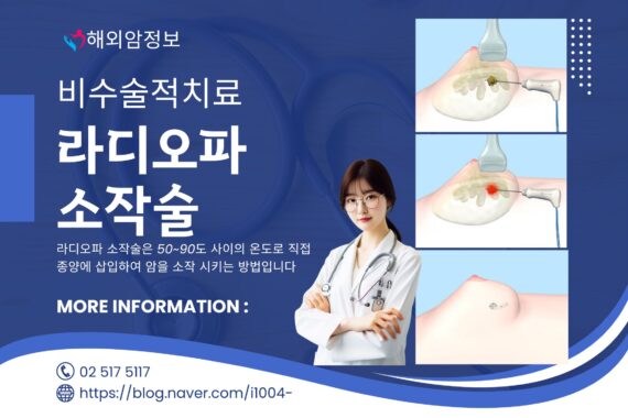 라디오파 소작술